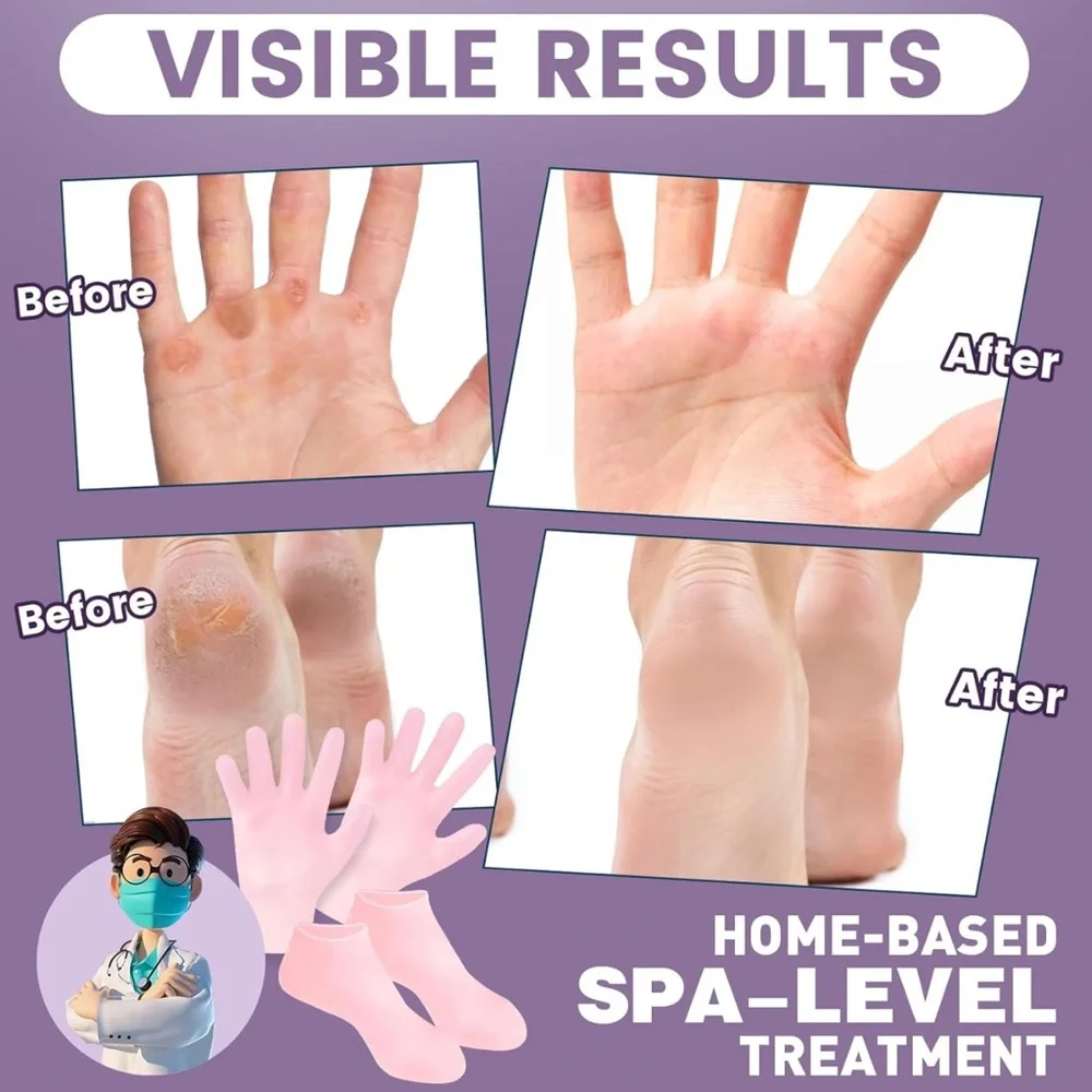Unisex Silicone Socks & Gloves for Dry Cracked Skin (Socks Fits Up to Size 8.5)